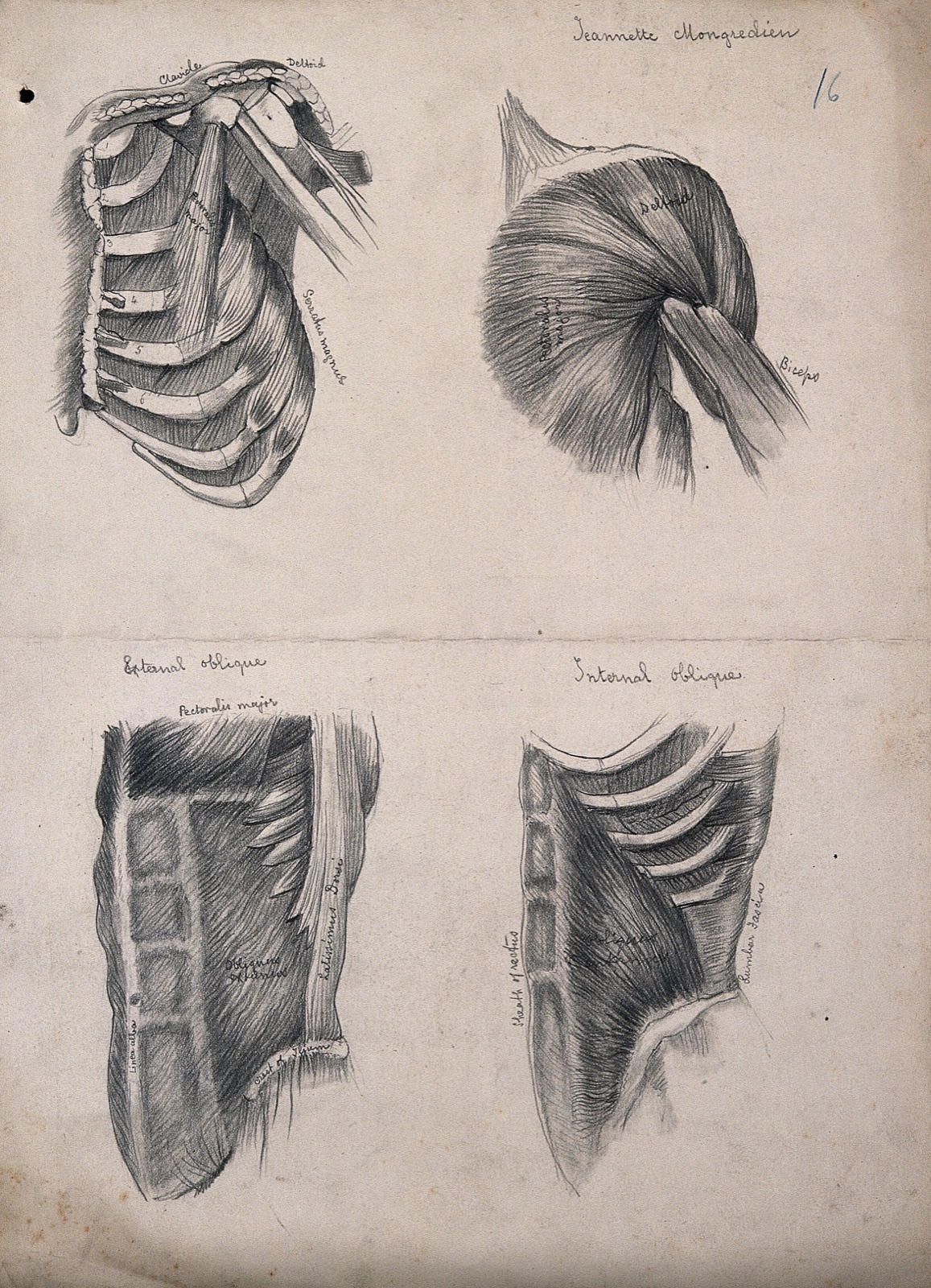 Muscles of the trunk: four figures, including the ribcage and shoulder. Pencil drawing by J. Mongrédien, ca. 1880. — Mongrédien, Jeannette.