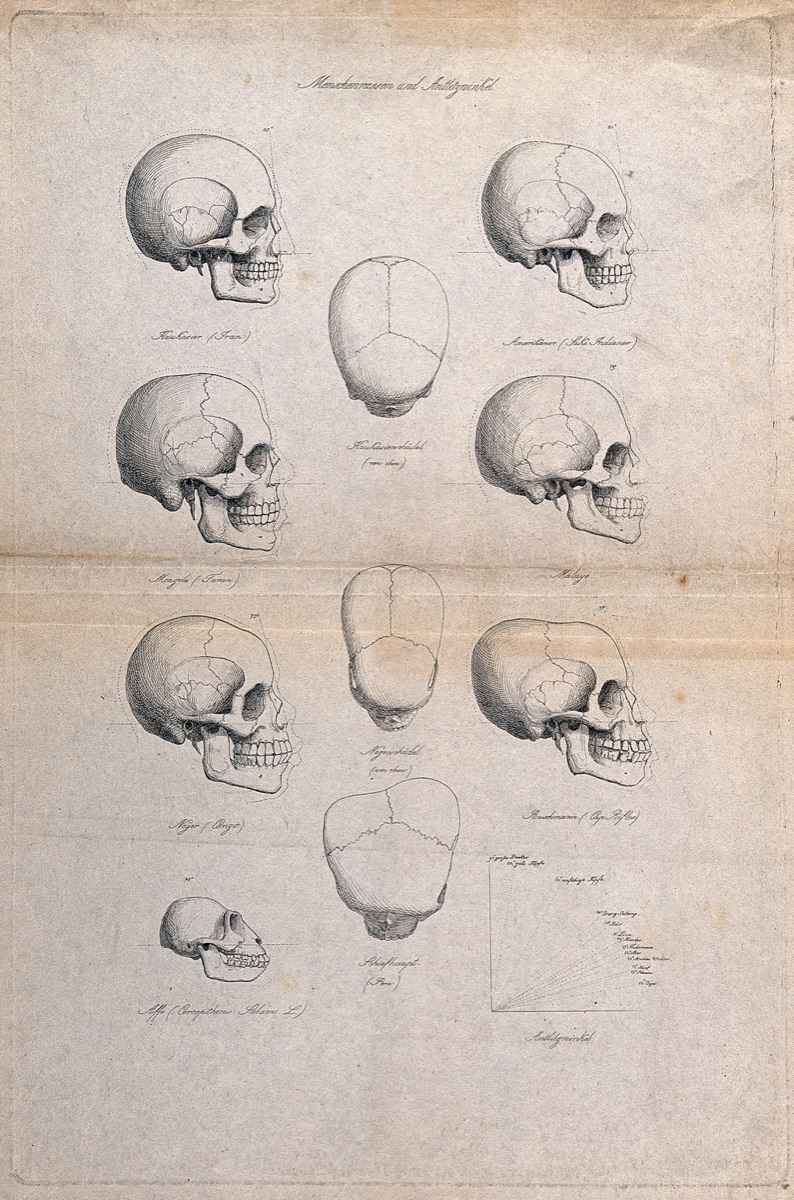 Human skulls of different racial types: eleven figures also including the skull of an ape, and a graph demonstrating different angles. Engraving.