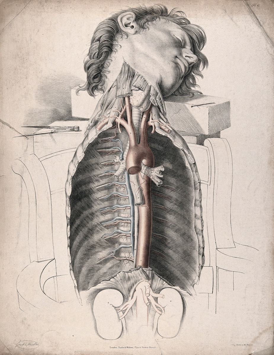 The circulatory system: dissection of the neck and thorax, with the arteries indicated in red and the veins in blue. Coloured lithograph by J. Maclise, 1841/1844. — Joseph Maclise