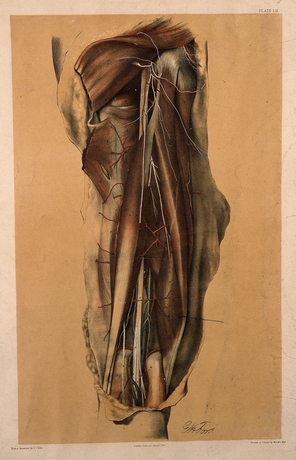 Dissection of the back of the thigh, showing the muscles, tendons, blood vessels and arteries. Colour lithograph by G.H. Ford, 1867. — George Henry Ford