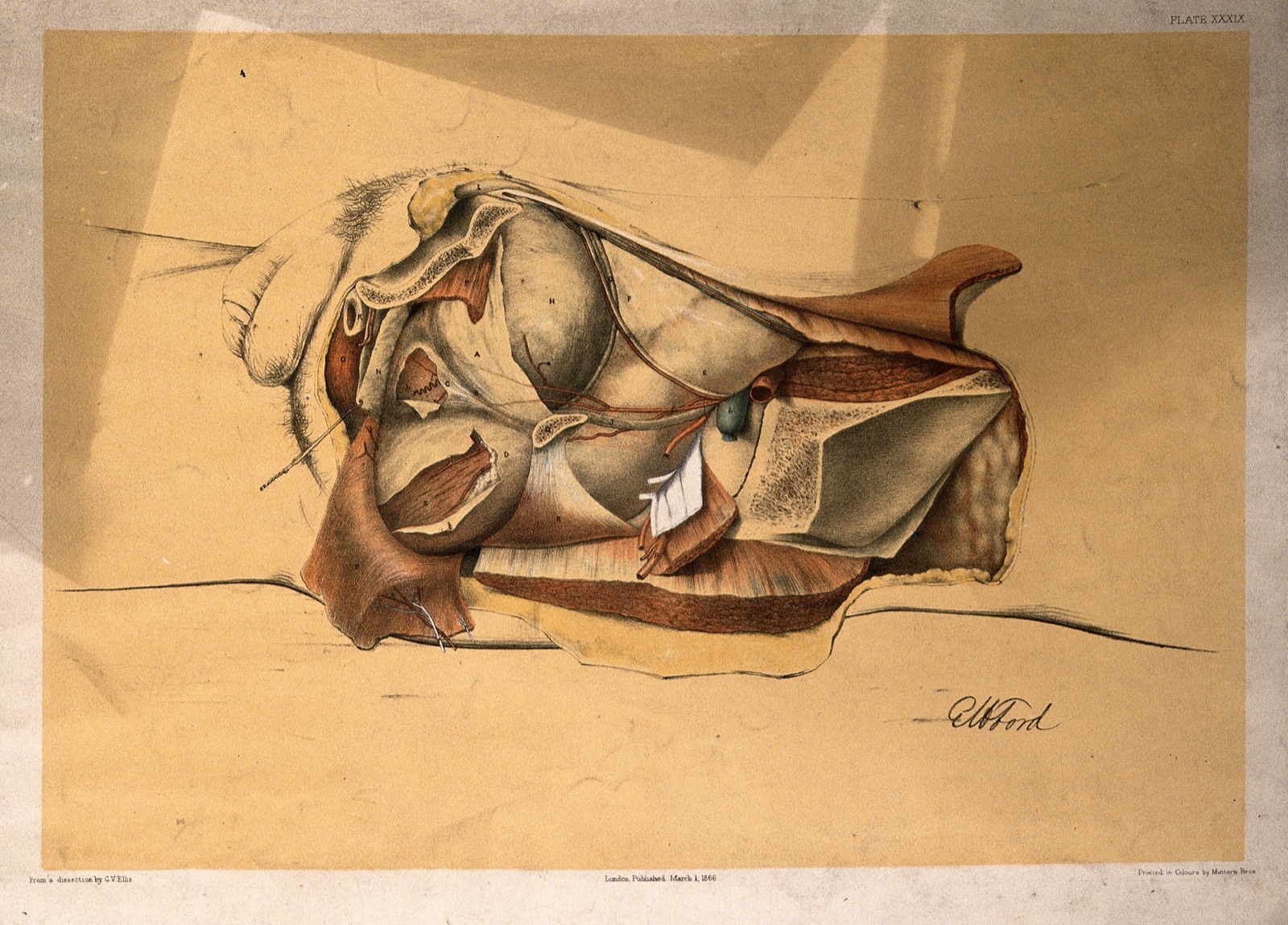 Dissection of the pelvis and abdomen of a man, showing the arteries, blood vessels, muscles and internal organs: side view. Colour lithograph by G.H. Ford, 1866. — George Henry Ford
