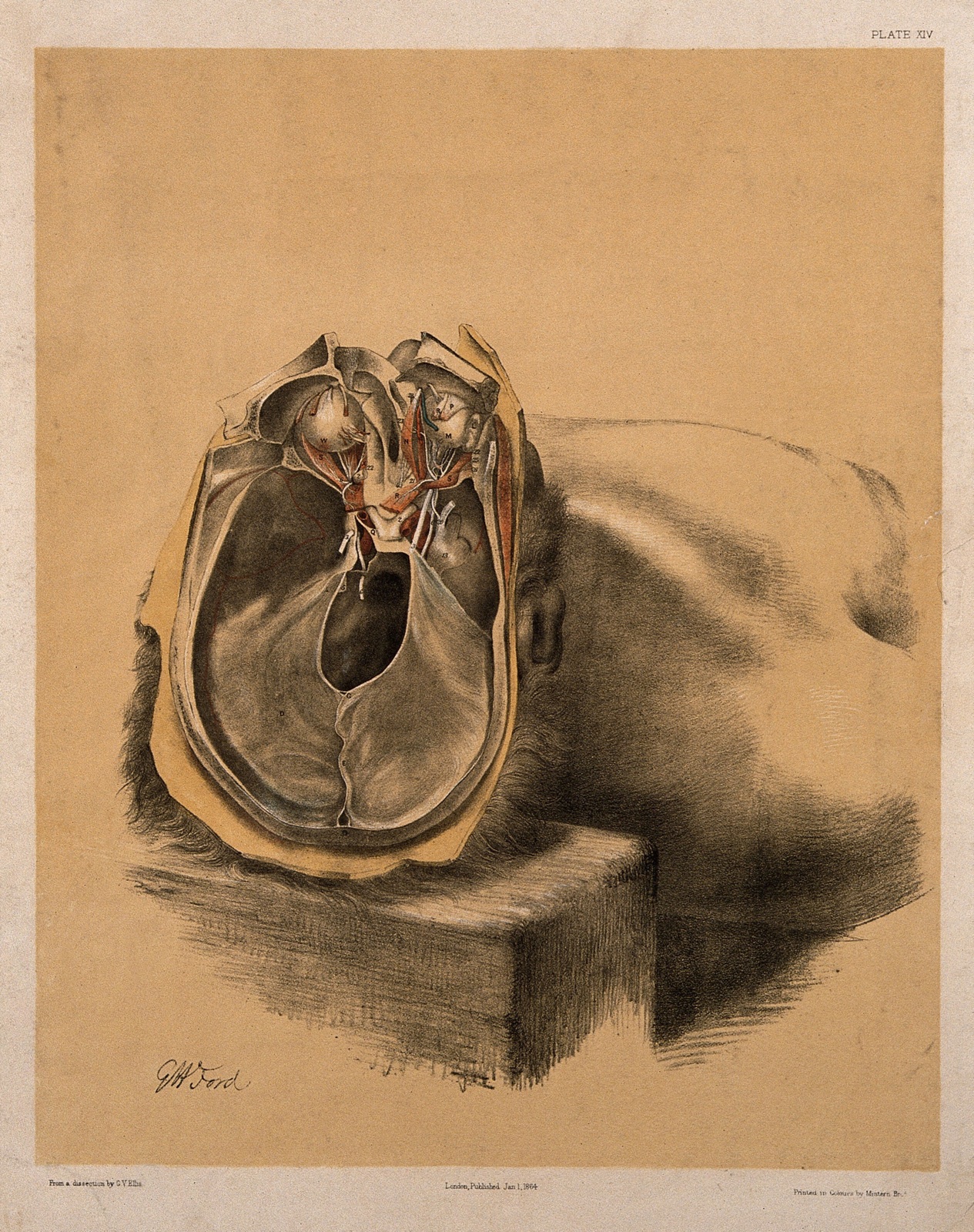 Dissection of the skull, showing the eyes with attached nerves and muscles. Colour lithograph by G.H. Ford, 1864. — George Henry Ford