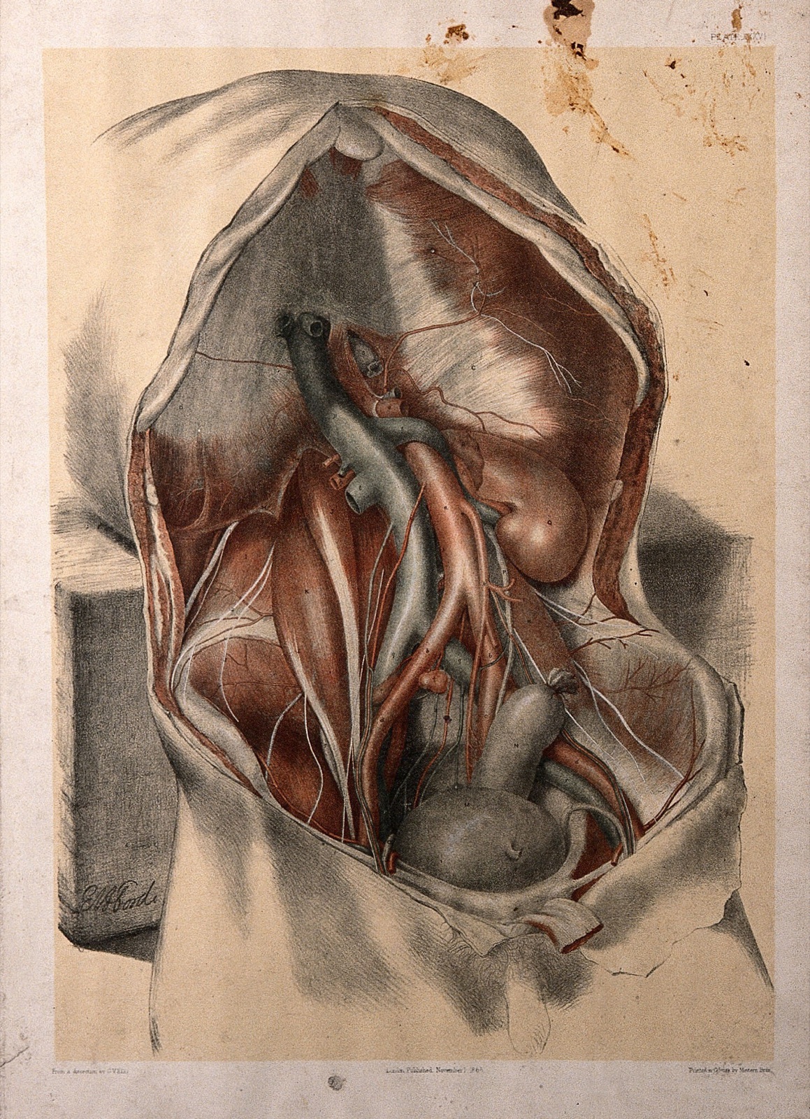 Dissection of the abdomen of a man, showing the arteries, veins, and internal organs. Colour lithograph by G.H. Ford, 1865. — George Henry Ford