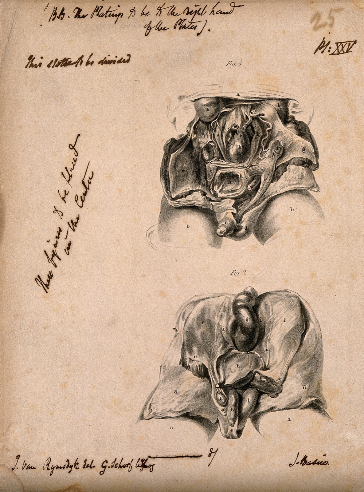 Dissection of the male abdomen: two figures. Lithograph by G. Scharf, after J. Van Rymsdyk, 1820/1840?. — Jan van Rymsdyk; George Johann Scharf