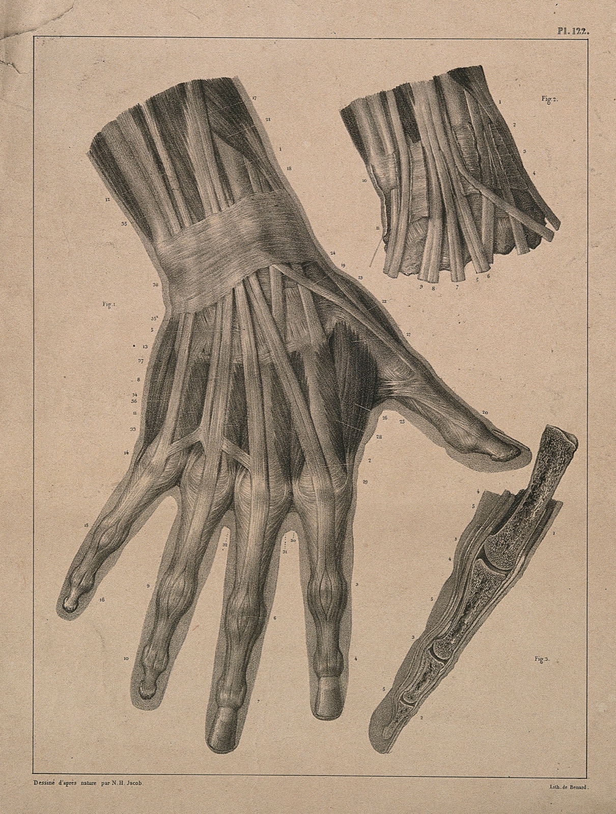 Muscles, tendons and bones of the hand: three figures. Lithograph by N.H Jacob, 1831/1854. — Nicolas-Henri Jacob