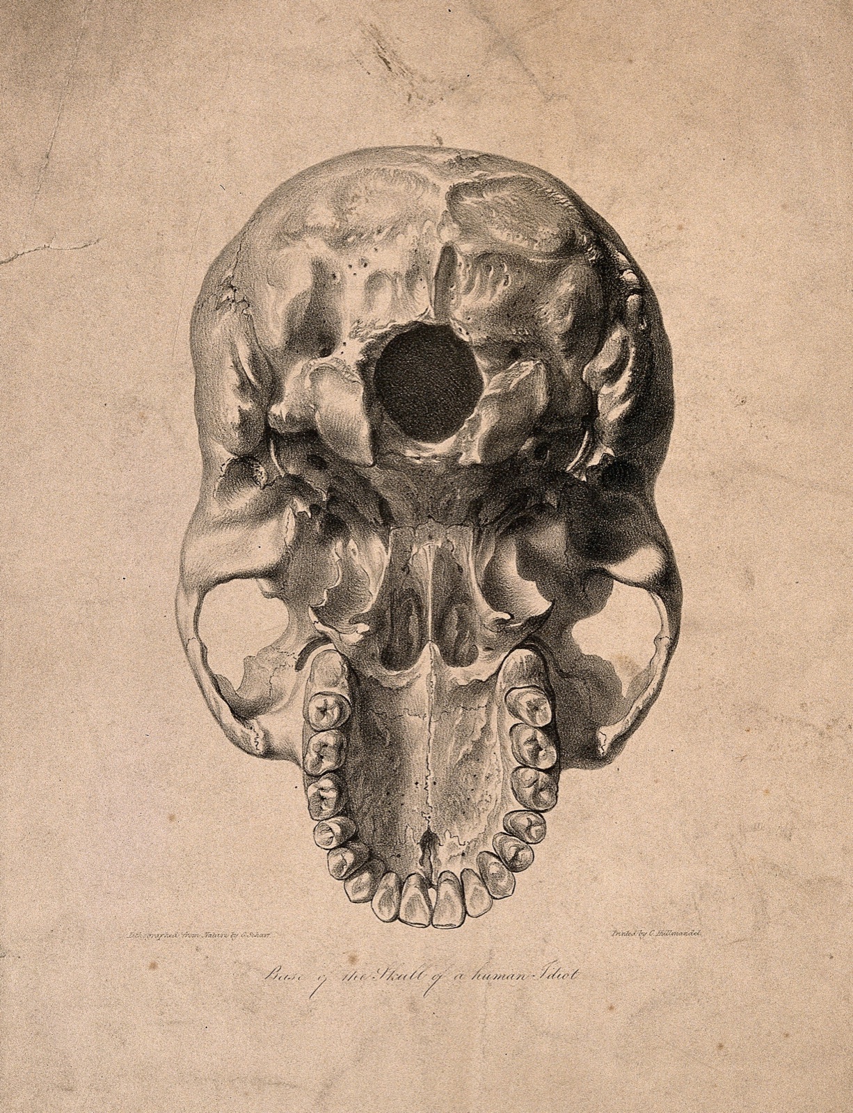 Skull of 'a human idiot' seen from below. Lithograph by G. Scharf, after J. Van Rymsdyk, 1820/1840?. — Jan van Rymsdyk; George Johann Scharf