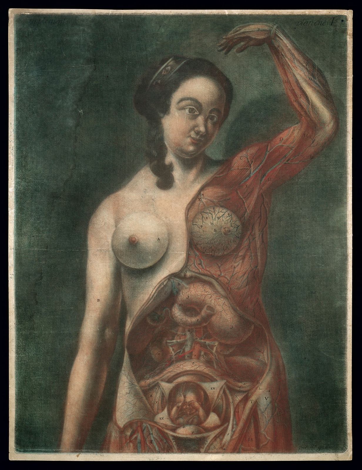A pregnant woman with the left side of her upper body and viscera exposed, her left arm raised above her head. Colour mezzotint by J.F. Gautier d'Agoty, 1759. — Jacques Fabien Gautier d'Agoty