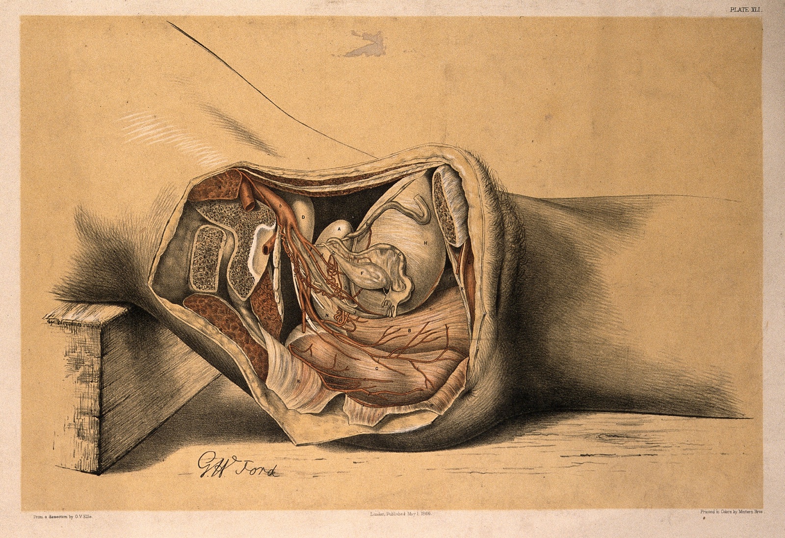 Dissection of the pelvis of a man, showing the arteries, blood vessels, muscles and internal organs: side view. Colour lithograph by G.H. Ford, 1866. — George Henry Ford